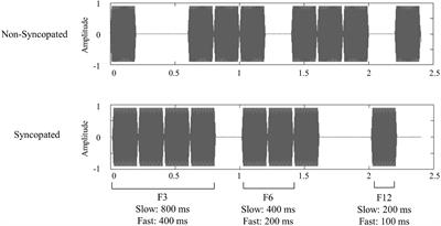 Aging effects on neural processing of rhythm and meter